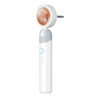 Otoscopio Digital Portátil con Cámara HD y Luz LED | Visualización en Tiempo Real para Oídos, Nariz, Piel y Mascotas | Herramienta Inteligente Recargable con Pantalla
