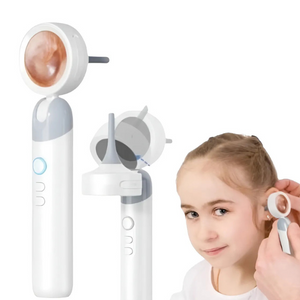 Otoscopio Digital Portátil con Cámara HD y Luz LED | Visualización en Tiempo Real para Oídos, Nariz, Piel y Mascotas | Herramienta Inteligente Recargable con Pantalla